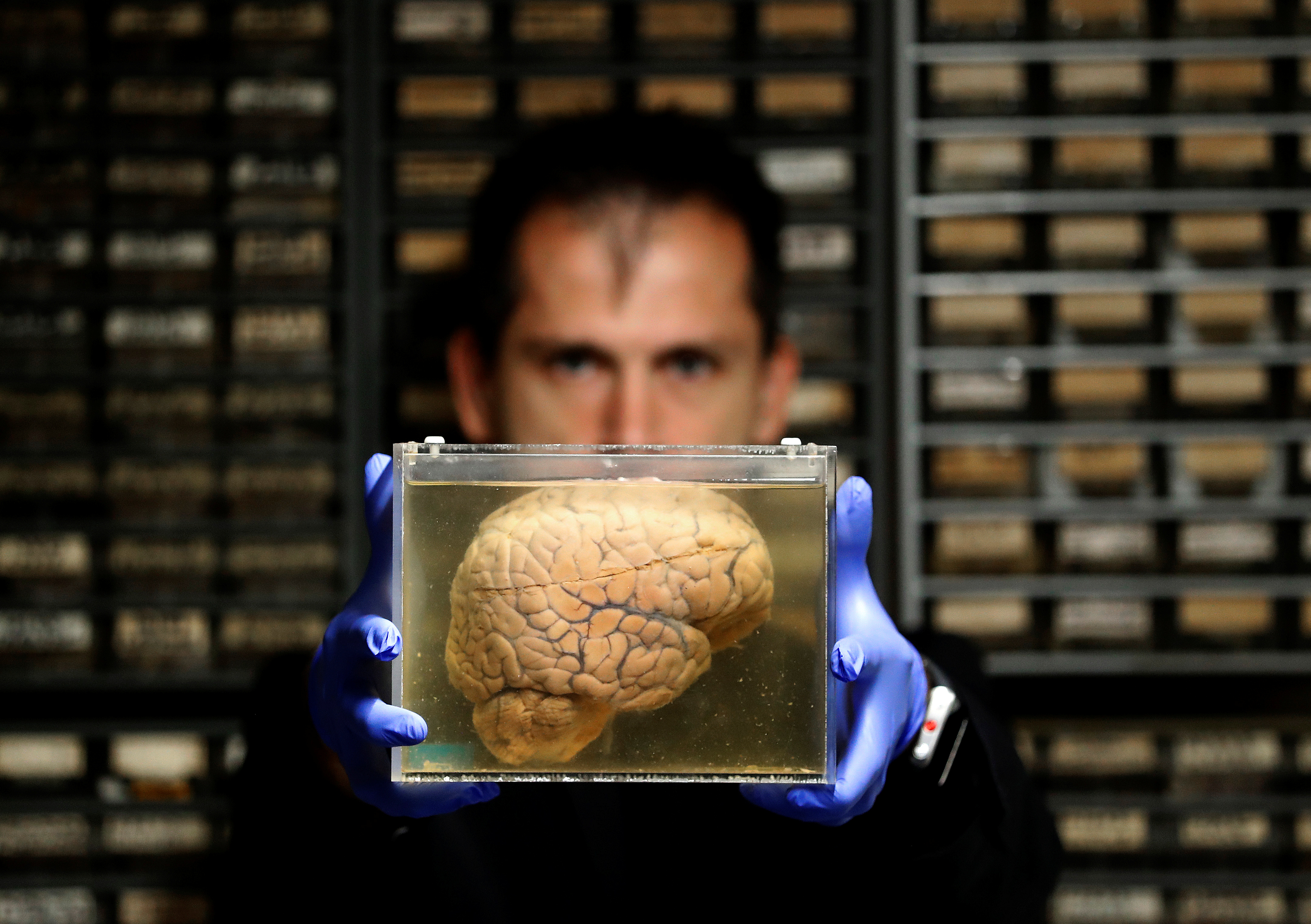 Настоящий человеческий. Человеческий мозг живой.