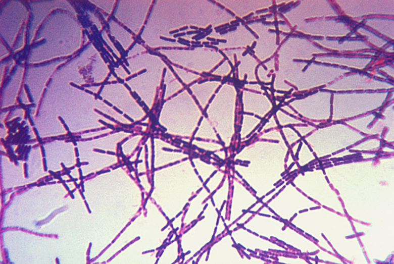 Бактерии Bacillus anthracis, вызывающие сибирскую язву. Фото: Centers for Disease Control and Prevention's Public Health Image Library