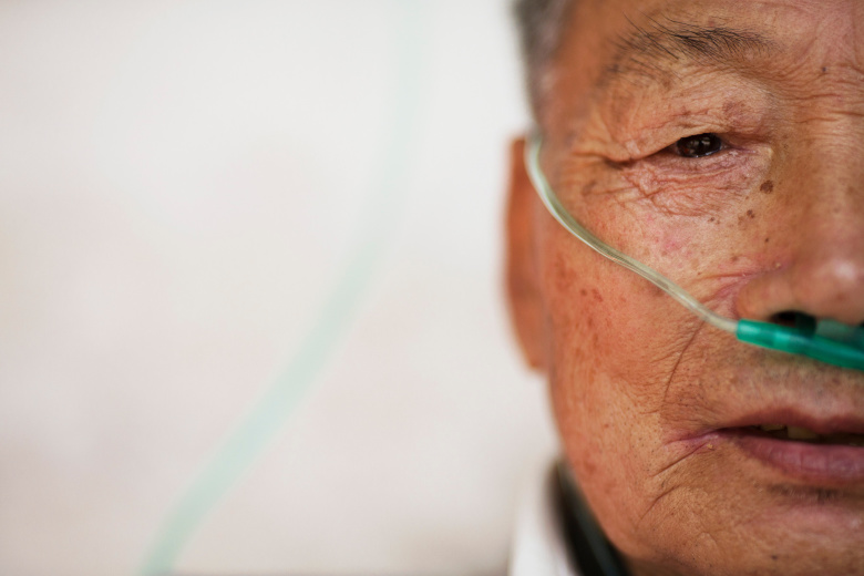 Пациент, страдающий пневмокониозом в госпитале провинции Чжэцзян, Китай