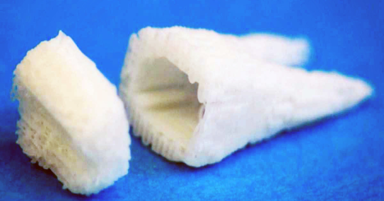 Пример "каркаса", с помощью которого можно вырастить коренной зуб. Фото: Columbia University Medical Center