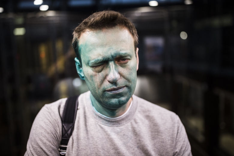 Алексей Навальный после нападения в Москве. Фото: Евгений Фельдман / Кампания Навального