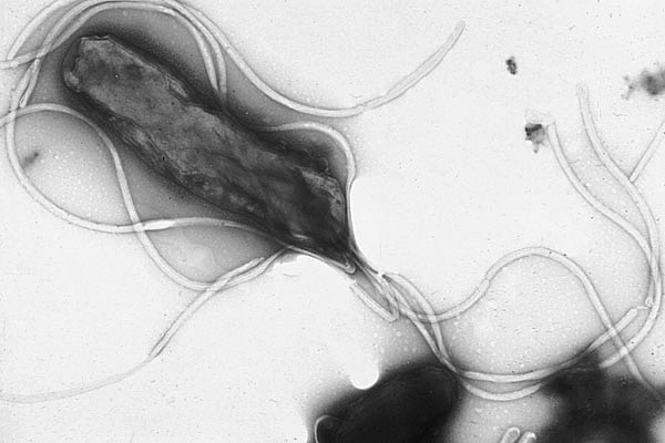 Helicobacter pylori. Микрофотография с использованием СЭМ