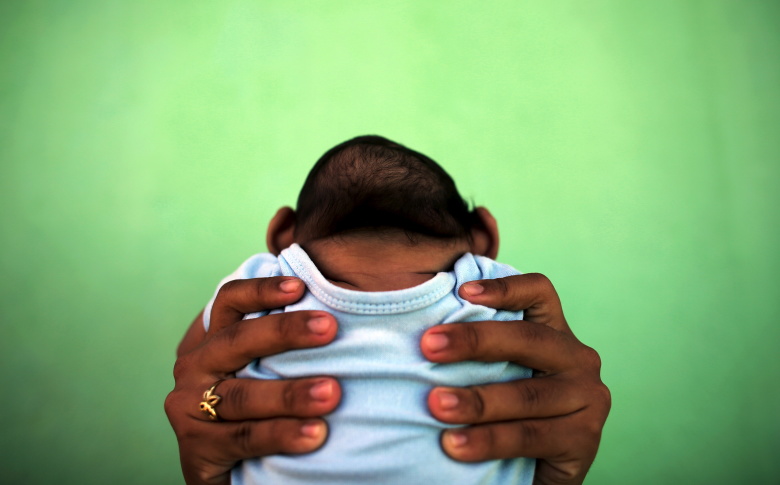 Мать, заразившаяся вирусом Зика, держит четырехмесячного ребенка с микроцефалией.