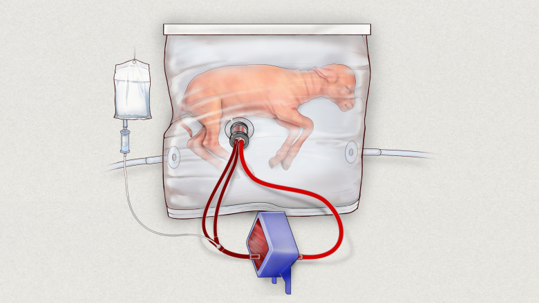 Искусственная матка, имитирующая внутриутробную среду. Устройство позволяет нормально развиваться помещенным внутрь ягнятам. Фото: Children's Hospital of Philadelphia / Reuters