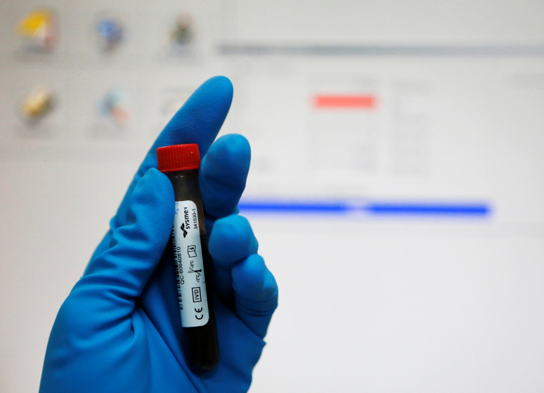 Образец крови для проведения теста на допинг в антидопинговой лаборатории в Москве
